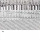 Garden Lounge Lænestol polstret stof og aluminium - Smart af Varaschin Viadurini