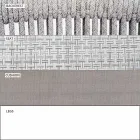 Garden Lounge Lænestol polstret stof og aluminium - Smart af Varaschin Viadurini