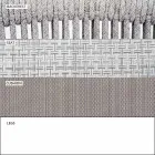 Garden Lounge Lænestol polstret stof og aluminium - Smart af Varaschin Viadurini